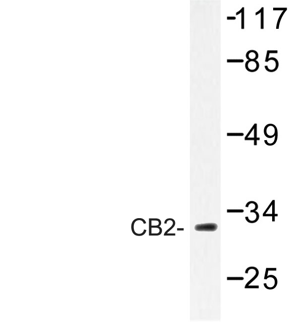CNR2 / CB2 Antibody - Western blot of CB2 (R334) pAb in extracts from COLO205 cells.
