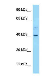 CNR2 / CB2 Antibody - CNR2 / CB2 antibody Western blot of 721_B Cell lysate. Antibody concentration 1 ug/ml.  This image was taken for the unconjugated form of this product. Other forms have not been tested.