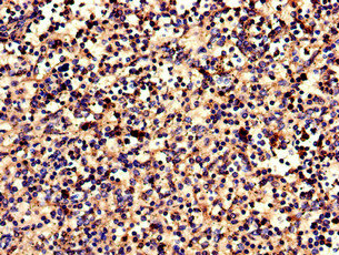 CNR2 / CB2 Antibody - Immunohistochemistry of paraffin-embedded human spleen tissue using CNR2 Antibody at dilution of 1:100
