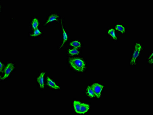 CNR2 / CB2 Antibody - Immunofluorescent analysis of HepG2 cells using CNR2 Antibody at a dilution of 1:100 and Alexa Fluor 488-congugated AffiniPure Goat Anti-Rabbit IgG(H+L)
