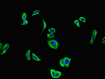 CNR2 / CB2 Antibody - Immunofluorescent analysis of HepG2 cells using CNR2 Antibody at dilution of 1:100 and Alexa Fluor 488-congugated AffiniPure Goat Anti-Rabbit IgG(H+L)