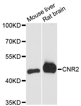CNR2 / CB2 Antibody - Western blot analysis of extracts of various cell lines, using CNR2 antibody at 1:3000 dilution. The secondary antibody used was an HRP Goat Anti-Rabbit IgG (H+L) at 1:10000 dilution. Lysates were loaded 25ug per lane and 3% nonfat dry milk in TBST was used for blocking. An ECL Kit was used for detection and the exposure time was 90s.