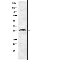 CNR2 / CB2 Antibody - Western blot analysis of CNR2 using COLO205 whole cells lysates