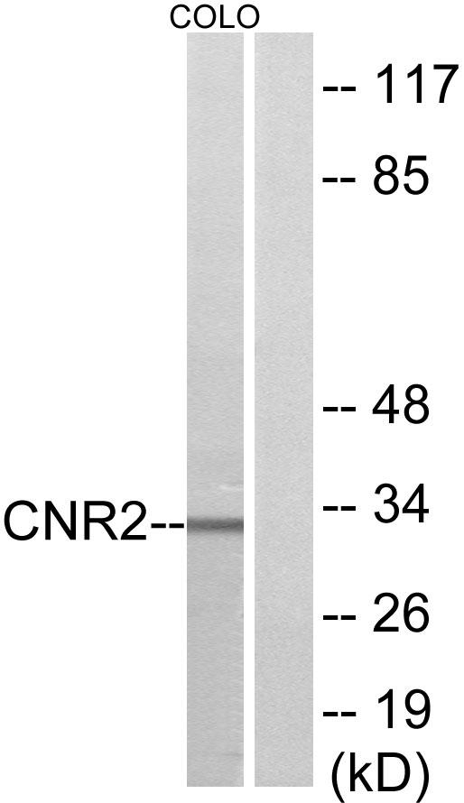 CNR2 / CB2 Antibody - Western blot analysis of extracts from COLO205 cells, using CNR2 antibody.
