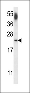 CNRIP1 Antibody - Western blot of lysate from human brain tissue lysate, using CNRP1 Antibody. Antibody was diluted at 1:1000 at each lane. A goat anti-rabbit IgG H&L (HRP) at 1:5000 dilution was used as the secondary antibody. Lysate at 35ug per lane.