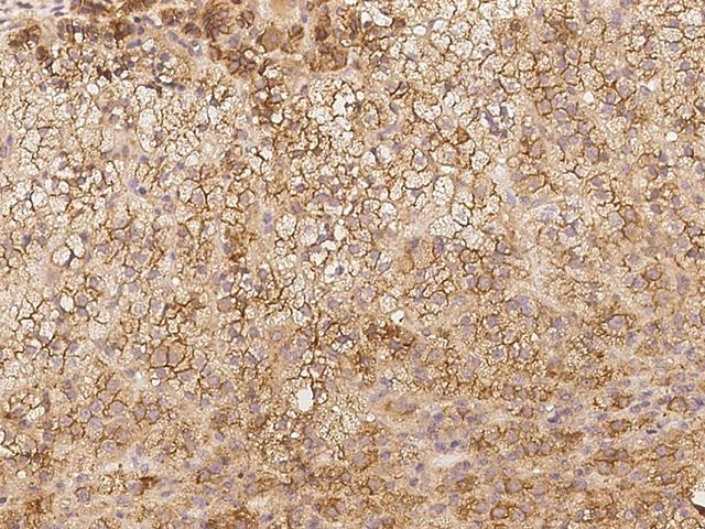 CNST Antibody - Immunochemical staining of human CNST in human adrenal gland with rabbit polyclonal antibody at 1:100 dilution, formalin-fixed paraffin embedded sections.