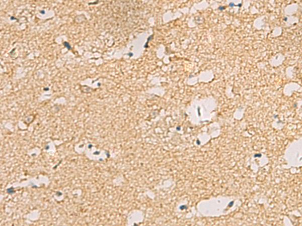 CNST Antibody - Immunohistochemistry of paraffin-embedded Human brain tissue  using CNST Polyclonal Antibody at dilution of 1:70(×200)