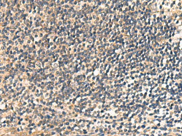 CNST Antibody - Immunohistochemistry of paraffin-embedded Human tonsil tissue  using CNST Polyclonal Antibody at dilution of 1:60(×200)