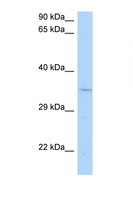 CNTD1 Antibody - CNTD1 / CNTD antibody Western blot of Rat Brain lysate. Antibody concentration 1 ug/ml.  This image was taken for the unconjugated form of this product. Other forms have not been tested.