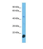 CNTD2 Antibody - Western blot of Human HepG2. CNTD2 antibody dilution 1.0 ug/ml.  This image was taken for the unconjugated form of this product. Other forms have not been tested.