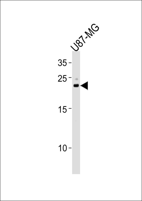 CNTF Antibody - CNTF Antibody western blot of U87-MG cell line lysates (35 ug/lane). The CNTF antibody detected the CNTF protein (arrow).