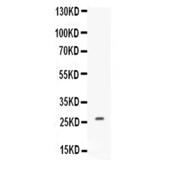 CNTF Antibody - Western blot analysis of CNTF expression in MCF-7 whole cell lysates (lane 1). CNTF at 27 kD was detected using rabbit anti-CNTF Antigen Affinity purified polyclonal antibody at 0.5 ug/mL. The blot was developed using chemiluminescence (ECL) method.
