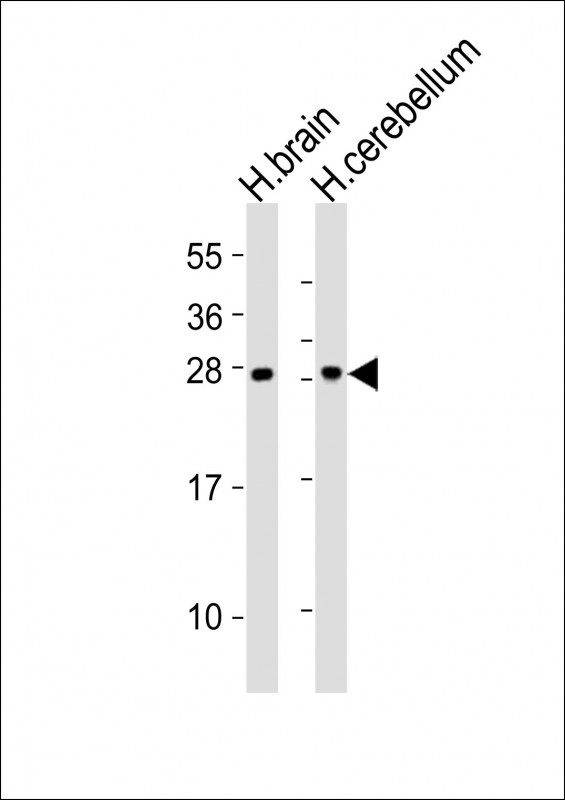 CNTF Antibody - All lanes : Anti-CNTF Antibody at 1:2000 dilution Lane 1: human brain lysates Lane 2: human cerebellum lysates Lysates/proteins at 20 ug per lane. Secondary Goat Anti-Rabbit IgG, (H+L), Peroxidase conjugated at 1/10000 dilution Predicted band size : 23 kDa Blocking/Dilution buffer: 5% NFDM/TBST.