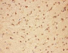 CNTF Antibody - IHC-P: CNTF antibody testing of mouse brain tissue