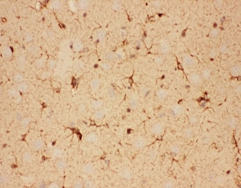 CNTF Antibody - IHC-P: CNTF antibody testing of rat brain tissue