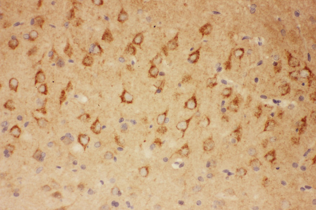 CNTF Antibody - CNTF antibody. IHC(P): Rat Brain Tissue.