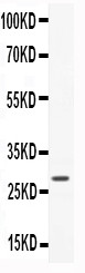 CNTF Antibody - WB of CNTF antibody. All lanes: Anti-CNTF at 0.5ug/ml. WB: Recombinant Human CNTF Protein 0.5ng. Predicted bind size: 28KD. Observed bind size: 28KD.