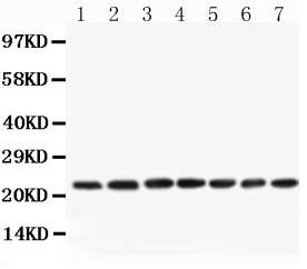 CNTF Antibody - Anti-CNTF Picoband antibody,-3. jpgAll lanes: Anti-CNTF at 0.5ug/ml Lane 1: PC-12 Whole Cell Lysate at 40ugLane 2: NRK Whole Cell Lysate at 40ugLane 3: RH35 Whole Cell Lysate at 40ugLane 4: Rat Brain Tissue Lysate at 40ugLane 5: Rat Liver Tissue Lysate at 40ug Lane 6: Rat Spleen Tissue Lysate at 40ug Lane 7: Rat Testis Tissue Lysate at 40ug Predicted bind size: 23KD Observed bind size: 23KD