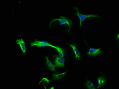 CNTF Antibody - Immunofluorescence staining of U251 cells with CNTF Antibody at 1:133, counter-stained with DAPI. The cells were fixed in 4% formaldehyde, permeabilized using 0.2% Triton X-100 and blocked in 10% normal Goat Serum. The cells were then incubated with the antibody overnight at 4°C. The secondary antibody was Alexa Fluor 488-congugated AffiniPure Goat Anti-Rabbit IgG(H+L).