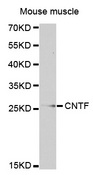 CNTF Antibody - Western blot analysis of extracts of Mouse muscle.