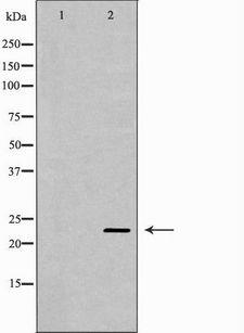 CNTF Antibody - Western blot analysis of extracts of mouse muscle using CNTF antibody. The lane on the left is treated with the antigen-specific peptide.