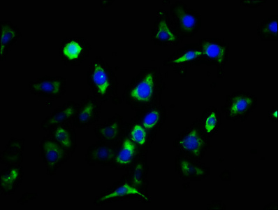 CNTFR Antibody - Immunofluorescence staining of SH-SY5Y cells with CNTFR Antibody at 1:133, counter-stained with DAPI. The cells were fixed in 4% formaldehyde, permeabilized using 0.2% Triton X-100 and blocked in 10% normal Goat Serum. The cells were then incubated with the antibody overnight at 4°C. The secondary antibody was Alexa Fluor 488-congugated AffiniPure Goat Anti-Rabbit IgG(H+L).