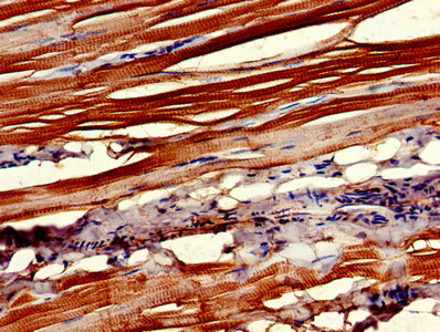 CNTFR Antibody - Immunohistochemistry of paraffin-embedded human skeletal muscle tissue using CNTFR Antibody at dilution of 1:100
