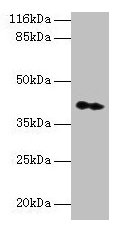 CNTFR Antibody - Western blot All lanes: CNTFR antibody at 2µg/ml + Hela whole cell lysate Secondary Goat polyclonal to rabbit IgG at 1/10000 dilution Predicted band size: 41 kDa Observed band size: 41 kDa