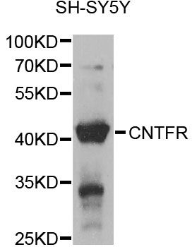 CNTFR Antibody - Western blot analysis of extracts of SH-SY5Y cells, using CNTFR antibody at 1:1000 dilution. The secondary antibody used was an HRP Goat Anti-Rabbit IgG (H+L) at 1:10000 dilution. Lysates were loaded 25ug per lane and 3% nonfat dry milk in TBST was used for blocking. An ECL Kit was used for detection and the exposure time was 3s.