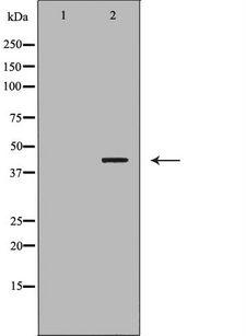 CNTFR Antibody - Western blot analysis of extracts of mouse heart tissue lysate using CNTFR antibody. The lane on the left is treated with the antigen-specific peptide.