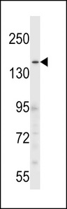 CNTLN Antibody - CNTLN Antibody western blot of HL-60 cell line lysates (35 ug/lane). The CNTLN antibody detected the CNTLN protein (arrow).
