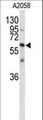 CNTN1 / gp135 / Contactin 1 Antibody - Western blot of CNTN1 Antibody in A2058 cell line lysates (35 ug/lane). CNTN1 (arrow) was detected using the purified antibody.