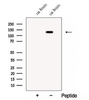 CNTN1 / gp135 / Contactin 1 Antibody - Western blot analysis of extracts of rat brain tissue using CNTN1 antibody. The lane on the left was treated with blocking peptide.