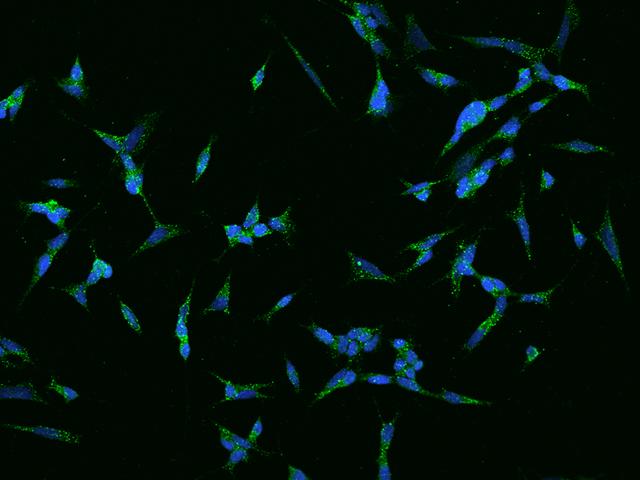CNTN1 / gp135 / Contactin 1 Antibody - Immunofluorescence staining of Contactin-1 in SHSY5Y cells. Cells were fixed with 4% PFA, permeabilzed with 0.1% Triton X-100 in PBS, blocked with 10% serum, and incubated with rabbit anti-Human Contactin-1 polyclonal antibody (dilution ratio 1:200) at 4°C overnight. Then cells were stained with the Alexa Fluor 488-conjugated Goat Anti-rabbit IgG secondary antibody (green) and counterstained with DAPI (blue). Positive staining was localized to Cytoplasm.
