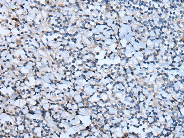 CNTN1 / gp135 / Contactin 1 Antibody - Immunohistochemistry of paraffin-embedded Human tonsil tissue  using CNTN1 Polyclonal Antibody at dilution of 1:55(×200)