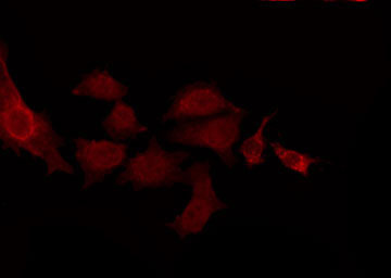 CNTN2 / TAX Antibody - Staining NIH-3T3 cells by IF/ICC. The samples were fixed with PFA and permeabilized in 0.1% Triton X-100, then blocked in 10% serum for 45 min at 25°C. The primary antibody was diluted at 1:200 and incubated with the sample for 1 hour at 37°C. An Alexa Fluor 594 conjugated goat anti-rabbit IgG (H+L) Ab, diluted at 1/600, was used as the secondary antibody.