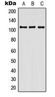 CNTN3 / Contactin 3 Antibody - Western blot analysis of Contactin 3 expression in HEK293T (A); SP2/0 (B); H9C2 (C) whole cell lysates.