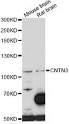 CNTN3 / Contactin 3 Antibody - Western blot analysis of extracts of various cell lines, using CNTN3 antibody at 1:1000 dilution. The secondary antibody used was an HRP Goat Anti-Rabbit IgG (H+L) at 1:10000 dilution. Lysates were loaded 25ug per lane and 3% nonfat dry milk in TBST was used for blocking. An ECL Kit was used for detection and the exposure time was 5min.