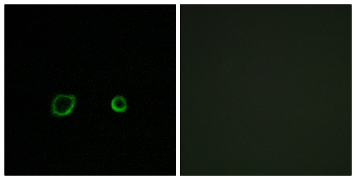 CNTN4 Antibody - Immunofluorescence analysis of A549 cells, using CNTN4 Antibody. The picture on the right is blocked with the synthesized peptide.