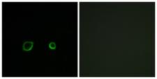 CNTN4 Antibody - Immunofluorescence analysis of A549 cells, using CNTN4 Antibody. The picture on the right is blocked with the synthesized peptide.