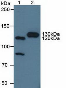 CNTN4 Antibody - Western Blot; Sample: Lane1: Human Hela Cells; Lane2: Porcine Brain Tissue.