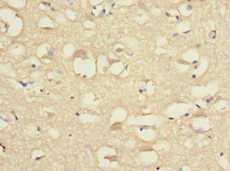 CNTN4 Antibody - Immunohistochemistry of paraffin-embedded human brain tissue at dilution 1:100