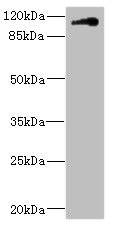 CNTN4 Antibody - Western blot All Lanes: CNTN4 antibody IgG at 1.79ug/ml+ HepG-2 whole cell lysate Secondary Goat polyclonal to rabbit IgG at 1/10000 dilution Predicted band size: 114,32,77 kDa Observed band size: 113 kDa
