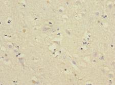 CNTN4 Antibody - Immunohistochemistry of paraffin-embedded human brain tissue at dilution 1:100
