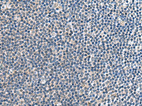 CNTN4 Antibody - Immunohistochemistry of paraffin-embedded Human tonsil tissue  using CNTN4 Polyclonal Antibody at dilution of 1:65(×200)