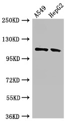 CNTN6 / Contactin 6 Antibody - Positive WB detected in:A549 whole cell lysate,HepG2 whole cell lysate;All lanes:CNTN6 antibody at 2.7?g/ml;Secondary;Goat polyclonal to rabbit IgG at 1/50000 dilution;Predicted band size: 114 KDa;Observed band size: 114 KDa;