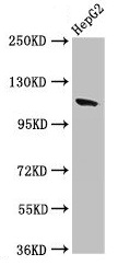 CNTN6 / Contactin 6 Antibody - Western Blot Positive WB detected in: HepG2 whole cell lysate All lanes: CNTN6 antibody at 2.7µg/ml Secondary Goat polyclonal to rabbit IgG at 1/50000 dilution Predicted band size: 114 kDa Observed band size: 114 kDa