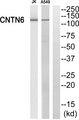 CNTN6 / Contactin 6 Antibody - Western blot analysis of extracts from Jurkat cells and A549 cells, using CNTN6 antibody.