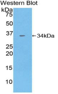CNTNAP1 / CASPR / p190 Antibody - Western blot of recombinant CNTNAP1 / CASPR / p190.  This image was taken for the unconjugated form of this product. Other forms have not been tested.