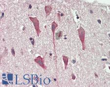 CNTNAP1 / CASPR / p190 Antibody - Human Brain, Cortex: Formalin-Fixed, Paraffin-Embedded (FFPE).  This image was taken for the unconjugated form of this product. Other forms have not been tested.